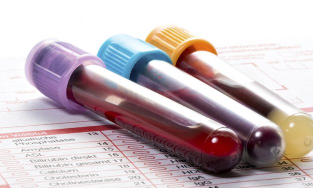 73% dintre cazurile de diabet pot fi omise dacă diagnosticul se bazează doar pe valorile hemoglobinei glicozilate