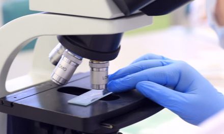 Tehnologie inovatoare în microscopie care poate ajuta la găsirea de noi tratamente pentru diabet