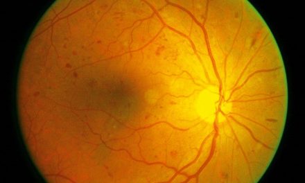 Diagnosticarea retinopatiei diabetice cu ajutorul algoritmilor AI