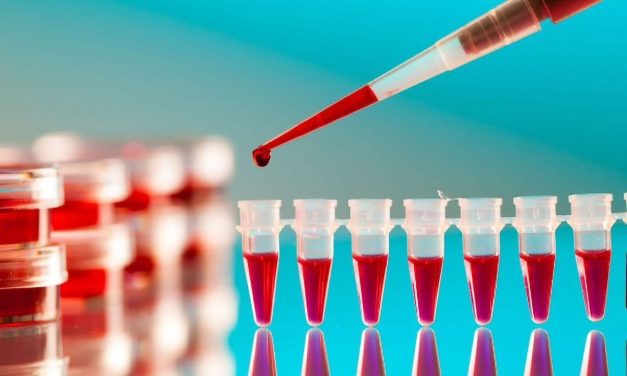 Studiu: 27 de proteine noi ​​ar putea prezice riscul bolilor de inimă