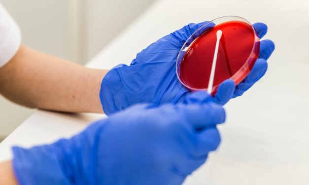 Oboseală, imunitate scăzută, piele uscată? Verifică-ți nivelul de zinc și seleniu