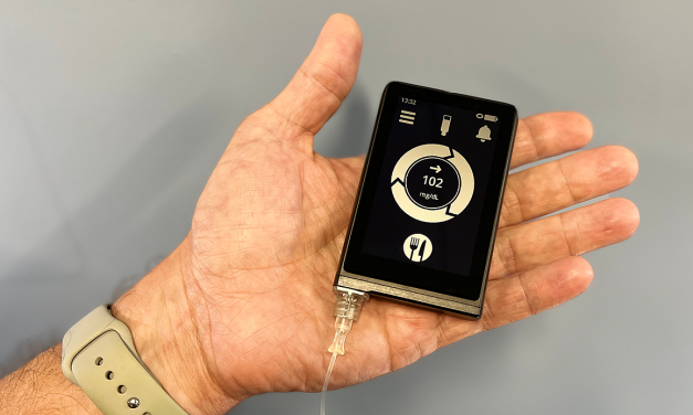 Un nou sistem automat de administrare a insulinei, descris ca „pancreas bionic”